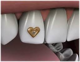 Dental Jewellery
